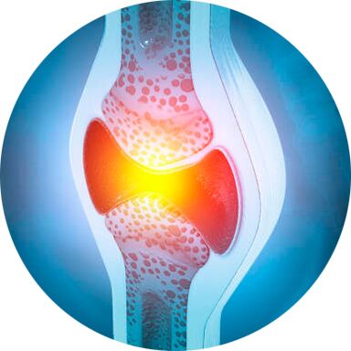 Processus de récupération des articulations avec le gel Icexin