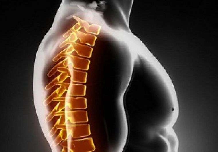L'ostéochondrose thoracique s'accompagne de douleurs et d'inconforts au milieu du dos