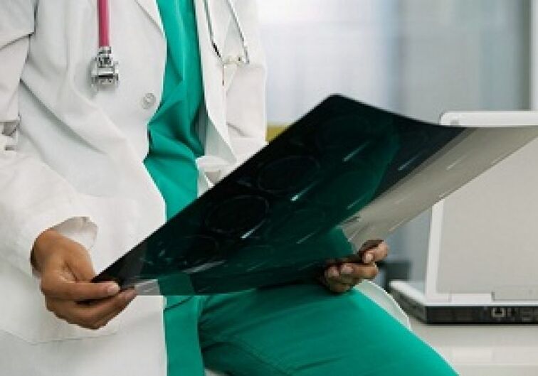 La radiographie aide le médecin à diagnostiquer « l’ostéochondrose de la colonne thoracique »